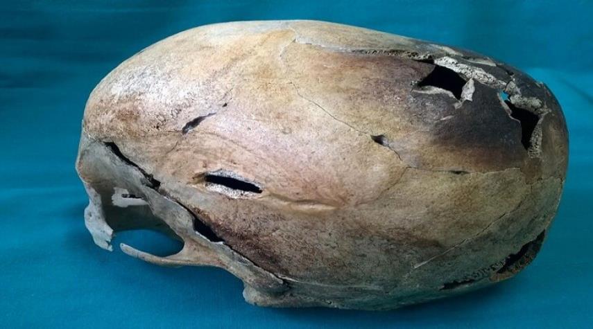 العثور على جمجمة عمرها 8 آلاف عام
