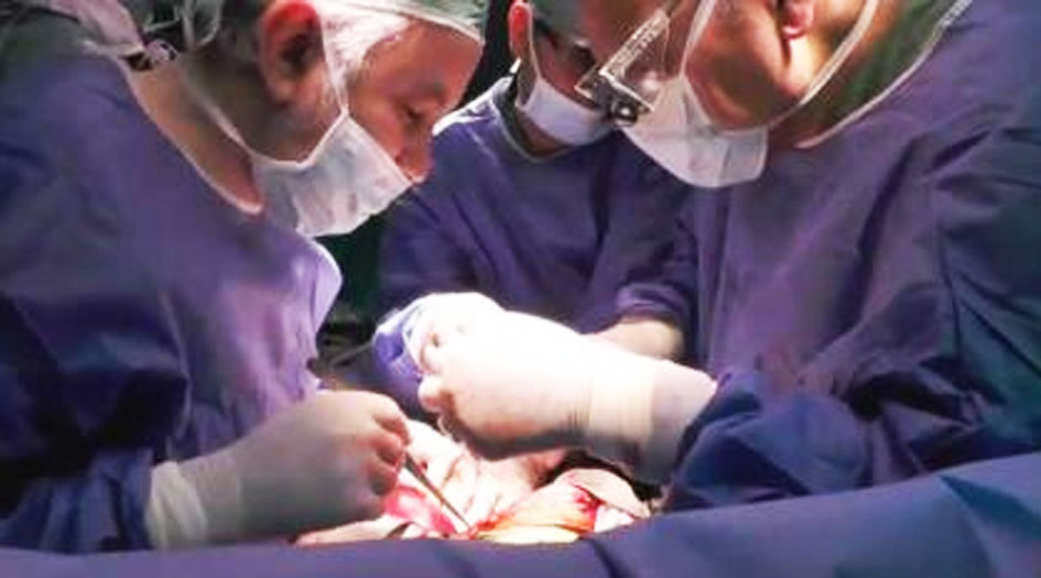 أطباء ايرانيون ينجحون في جراحة لإعادة السمع للصم