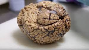 دماغ غامض يكتشف في جمجمة مقتول!!