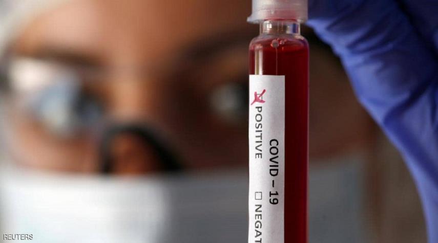 ما هي فصيلة الدم الأكثر عرضة للكورونا؟
