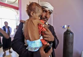 محافل اعلامية : اليمن سيواجه أسوأ مجاعة عام 2020