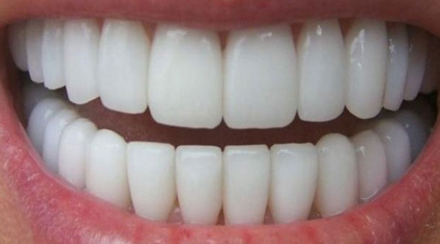 كيفية إزالة الجير من الأسنان بطرق طبيعية