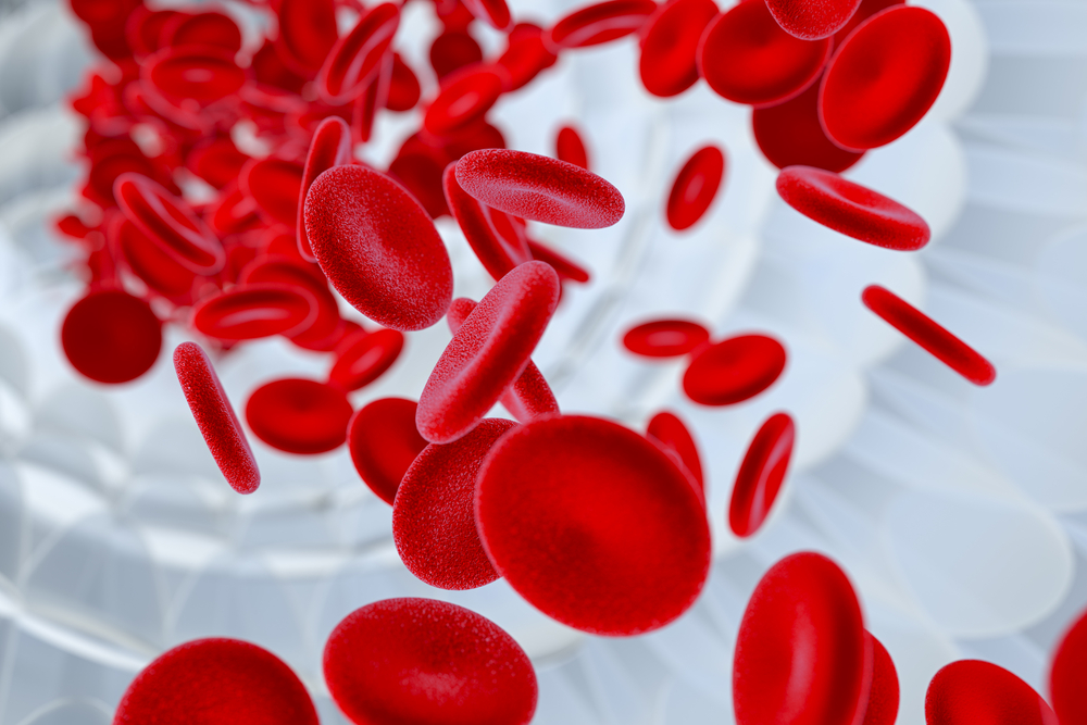 ما هو مرض فقر الدم الخبيث وآثاره وكيفية علاجه؟