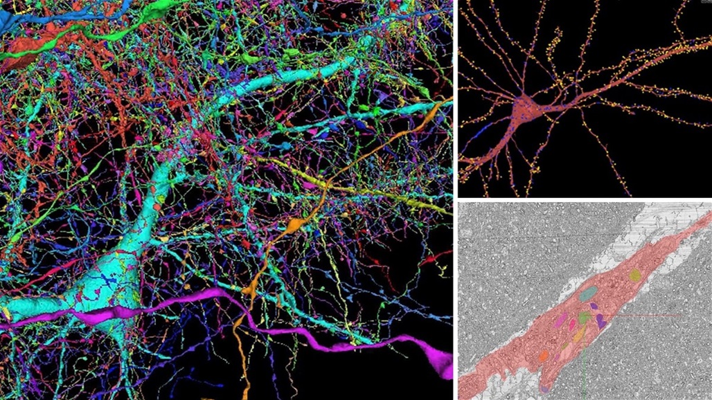 بـ225 مليون صورة.. خريطة ثلاثية الأبعاد لجزء صغير من دماغ الإنسان
