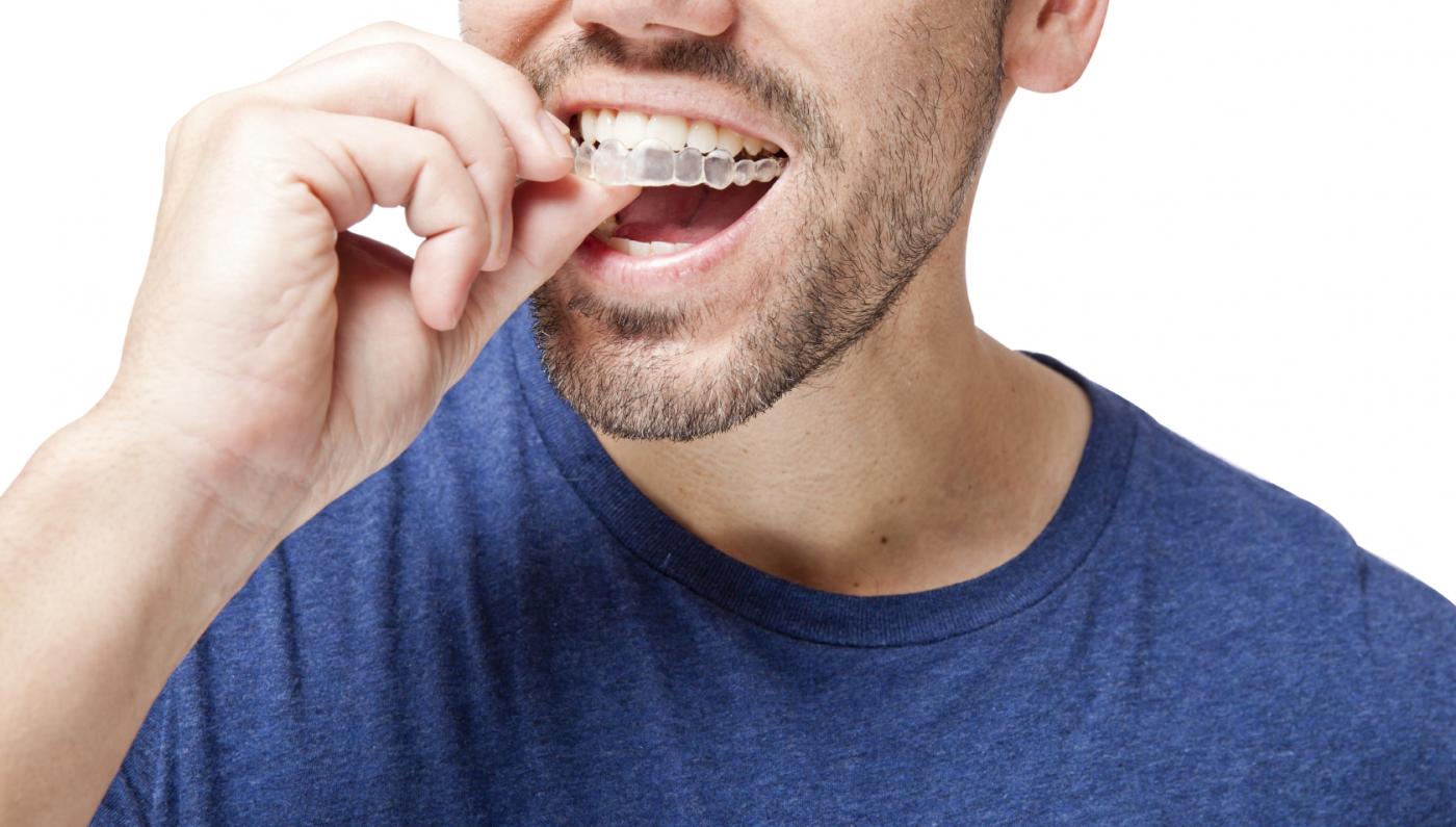 أضرار ومخاطر استخدام تقويم الأسنان.. تعرف عليها