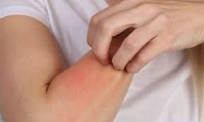 علامات تحذيرية على الجلد تشير إلى الإصابة بالسكري