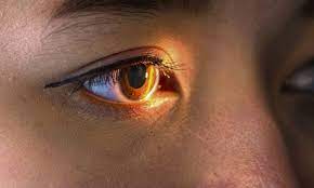 هل تقضي "عيون الذباب" على العمى عند البشر؟