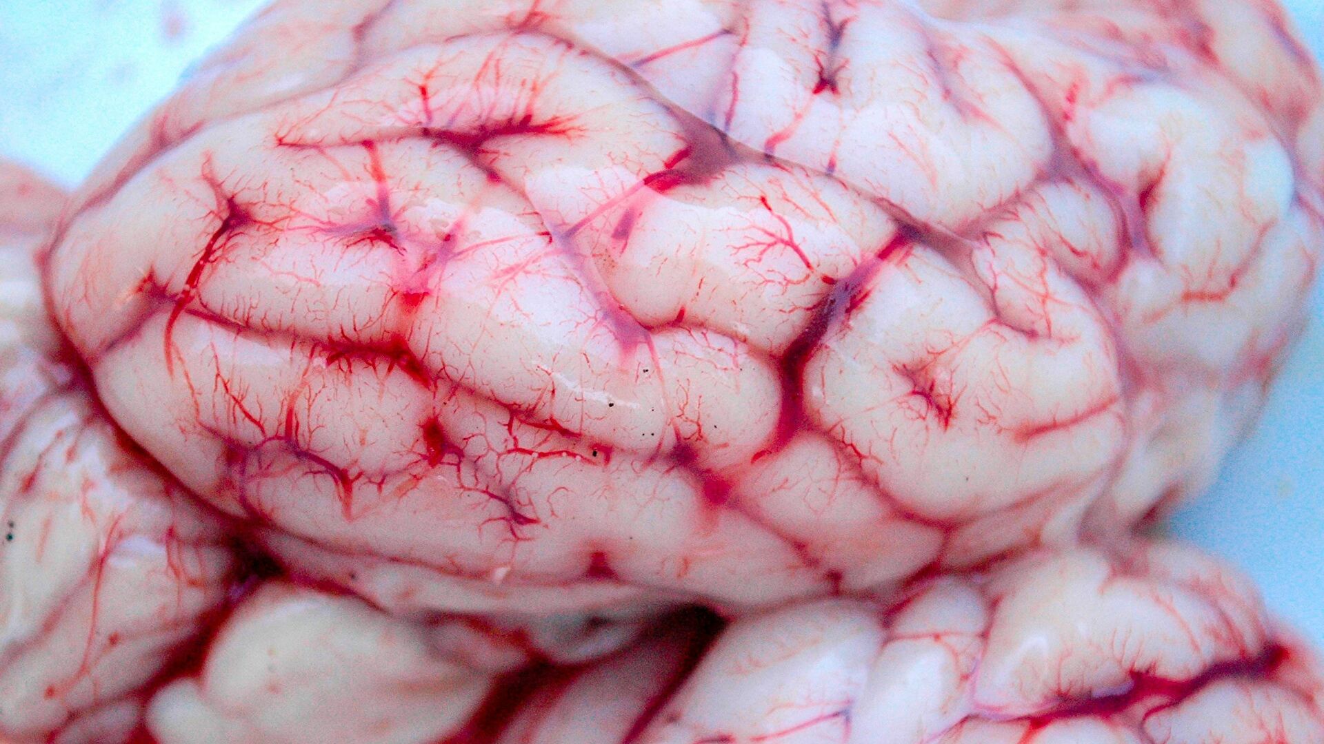 دراسة : مرض "كوفيد 19" قد يسبب إنكماشا في الدماغ!