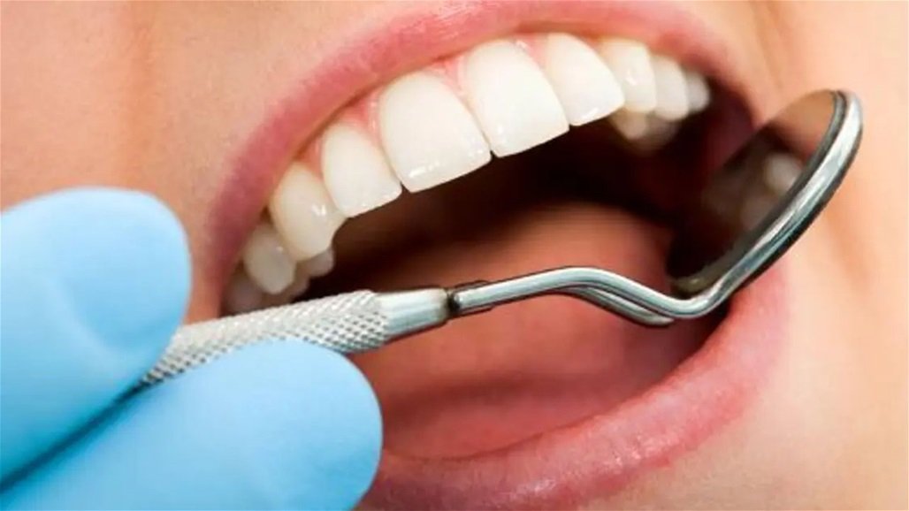 مع هذه التقنية ... وداعاً لمضاعفات تسوس الاسنان