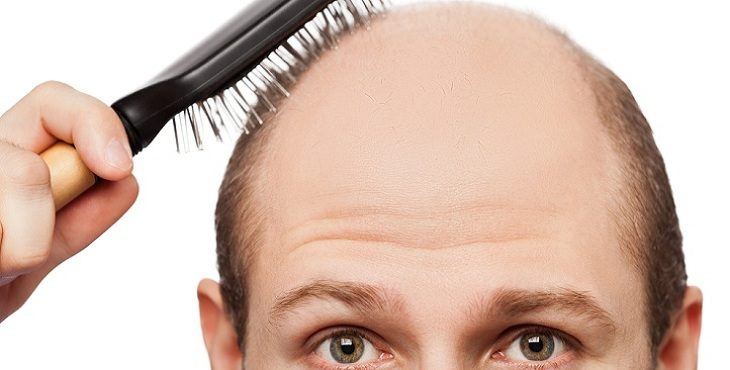 الكشف عن دواء واعد لإنتاج بصيلات شعر