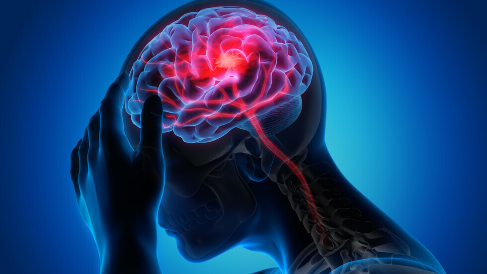 تعرف على أعراض غير شائعة للسكتة الدماغية