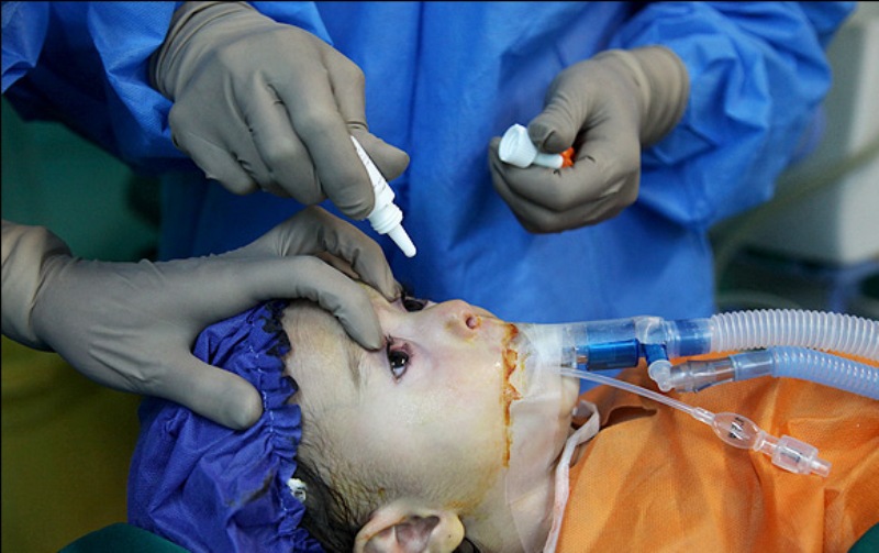إقبال المرضى الأجانب على طبابة العيون في ايران
