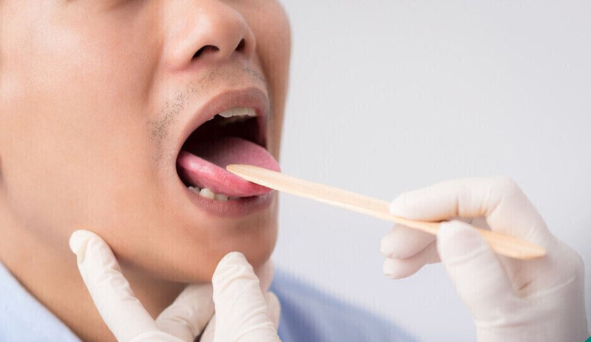 علامات في الفم قد تشير إلى وجود حالات صحية "قاتلة"
