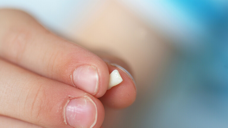 السمنة تزيد من خطر فقدان الاسنان