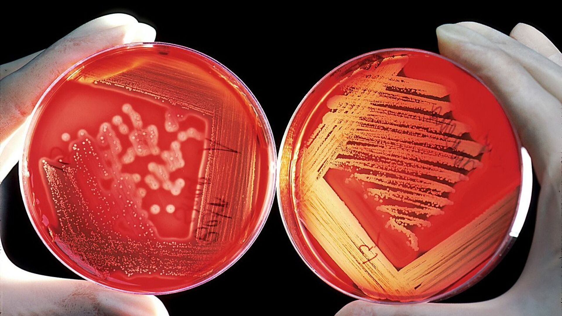 تجربة عالمية لنقل لخلايا الدم الحمراء المزروعة في المختبر!