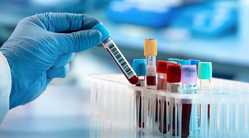 علماء الأحياء يطورون اختباراً للدم بقدرة عالية على تشخيص مرض ألزهايمر