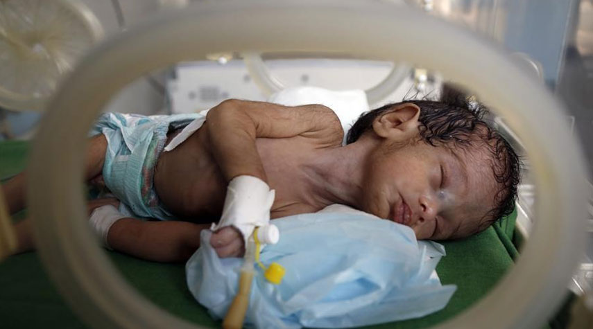 الصحة اليمنية: 80 طفلاً حديثي الولادة يموتون يومياً بفعل العدوان والحصار