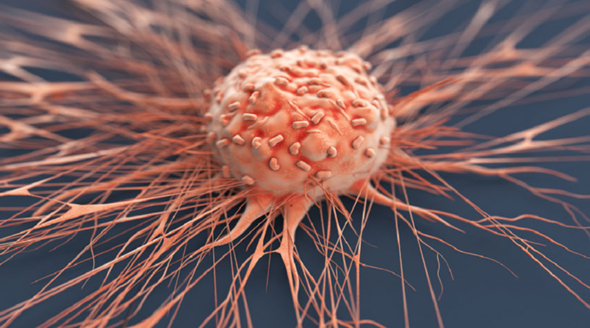 6 أشياء اكتشف الباحثون أن السرطان مرتبط بها