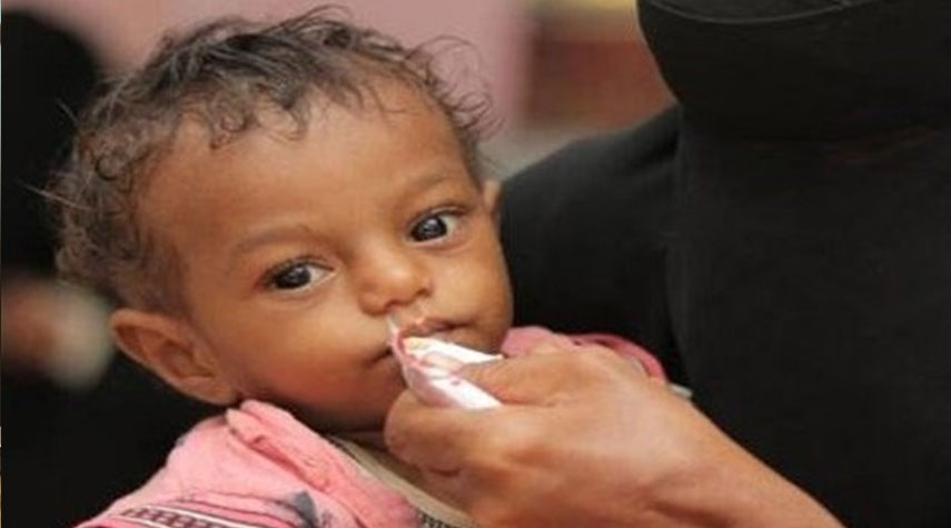 صنعاء.. أكثر من 61% من سكان اليمن يعانون انعدام الأمن الغذائي