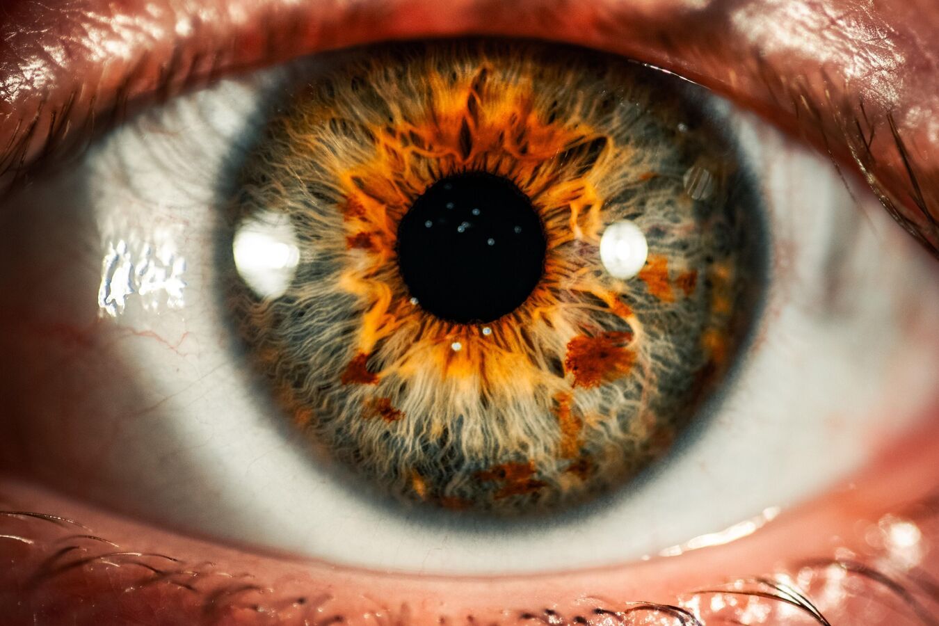 علاجا جينيا فعالا لالتهاب شبكية العين