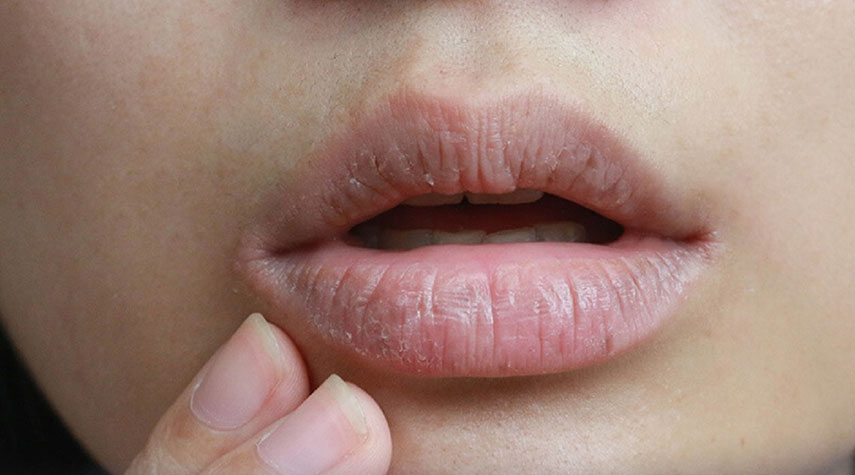 هل يمكن أن يكون جفاف الفم علامة على مشكلة صحية خطيرة؟