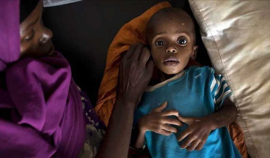 أرقام مفزعة.. الجوع سيقتل شخصاً واحداً كل 28 ثانية في شرق أفريقيا