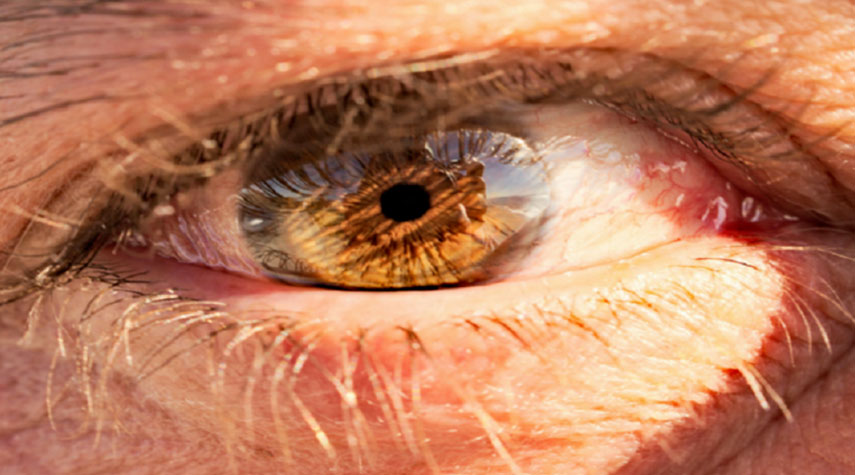 اكتشاف طريقة لتحديد الأعراض المبكرة للخرف في العينين