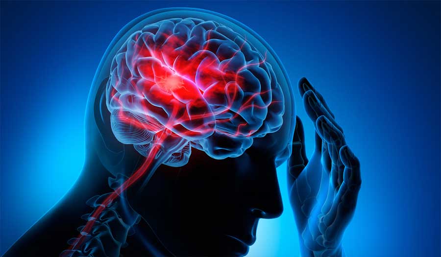 باحثون يطورون تقنية تتنبأ بخطر السكتة الدماغية