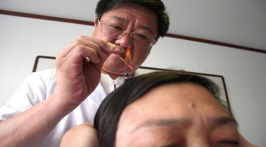 طبيبة مختصة: "الإبر الصينية" لم تثبت فعاليتها علمياً