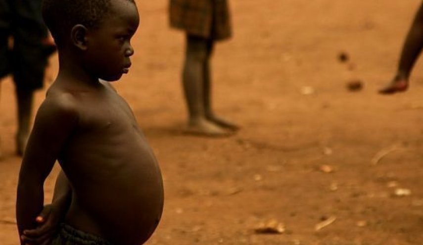 لماذا تنتفخ بطن الأطفال الذين يعانون من سوء التغذية؟