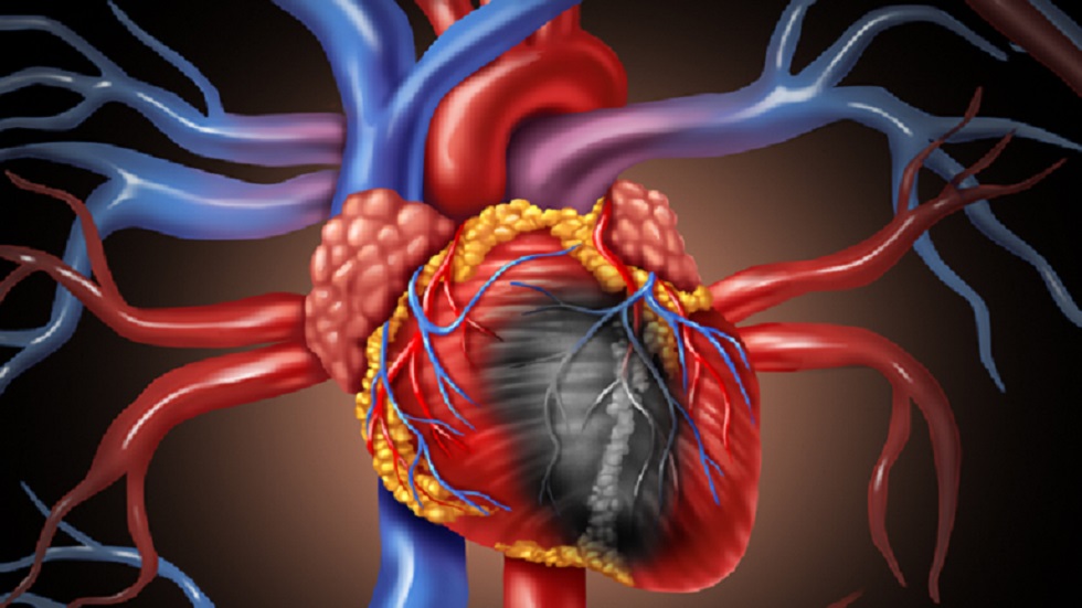 عامل مهمل يزيد خطر الإصابة باحتشاء عضلة القلب!