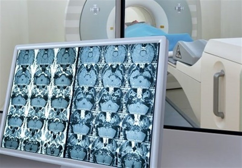 تفاصيل جديدة عن علاج نووي لمرضى السرطان في إيران