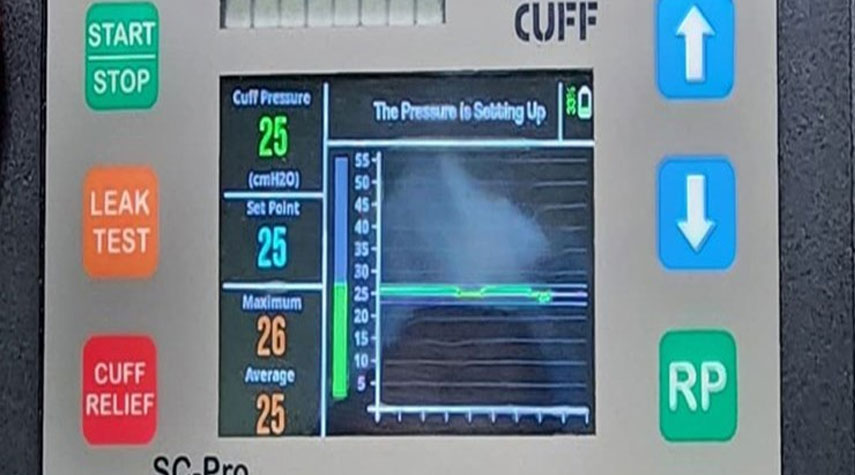 شركة إيرانية تنتج جهاز قياس ضغط القصبات الهوائية الذكي لمساعدة مرضى الجهاز التنفسي