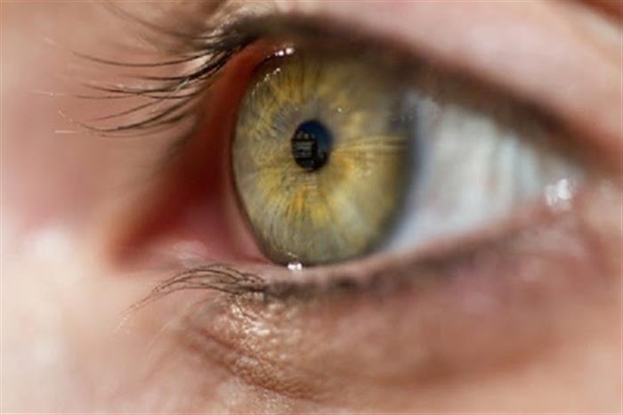 تعرف على أعراض سرطان العين وأسبابها