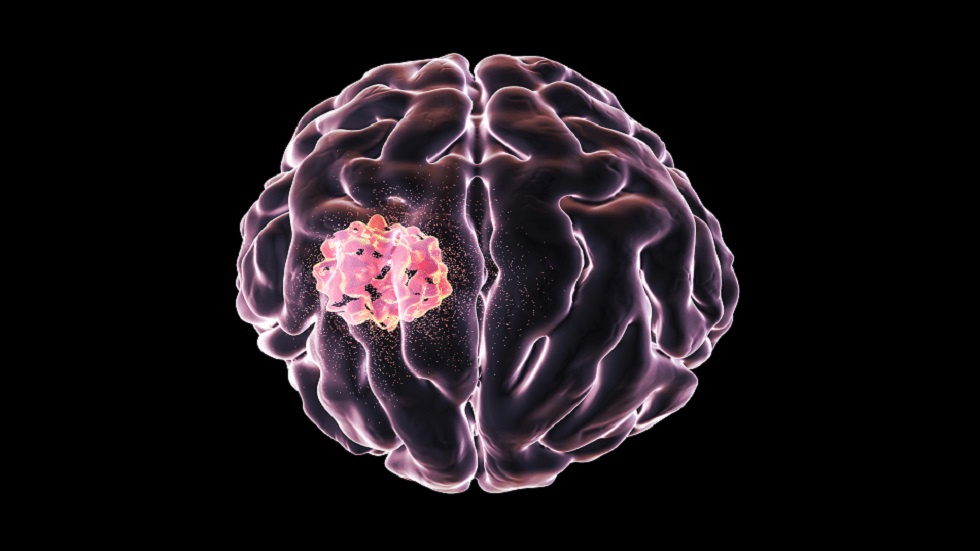 "عقار" لعلاج أخطر أنواع سرطان الدماغ