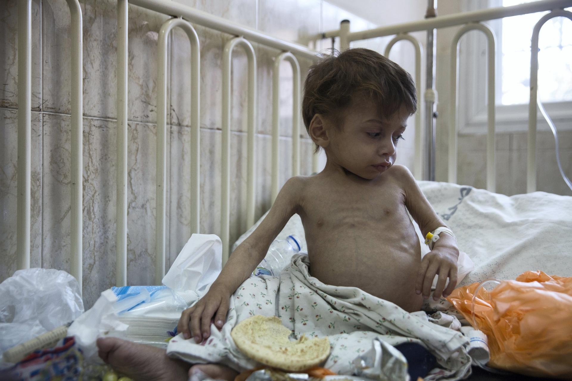 وفاة 7 أطفال في مستشفى كمال عدوان شمالي غزة نتيجة العدوان الإسرائيلي