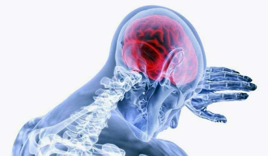 ما هي السلوكيات التي تزيد خطر الإصابة بالسكتة الدماغية؟