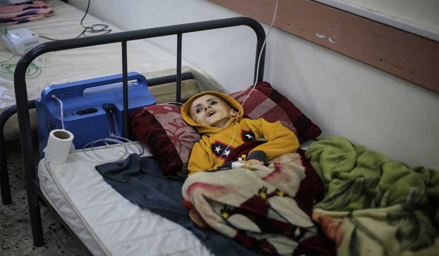 غضب عارم يجتاح مواقع التواصل بعد استشهاد الطفل يزن الكفارنة جوعا في غزة