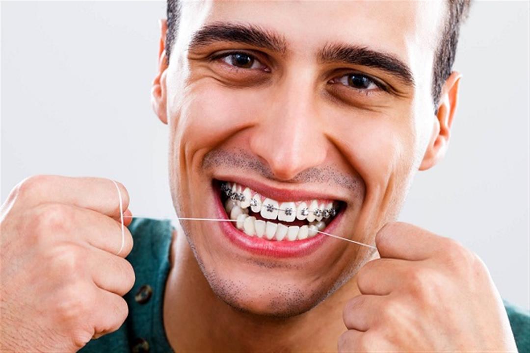 دراسة توضح.. هل يؤثر تقويم الأسنان على الدماغ؟