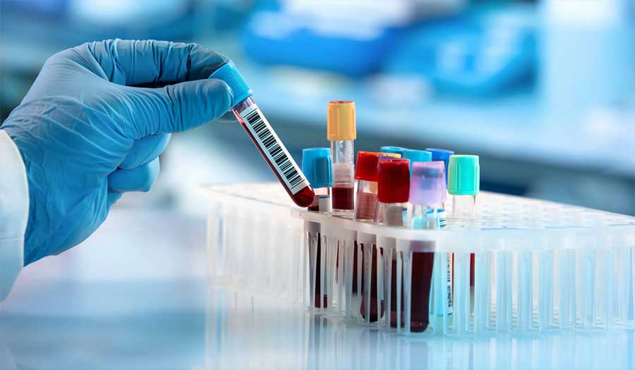 دراسة: اختبار دم بسيط يكشف مبكرا عن الإصابة بالسرطان
