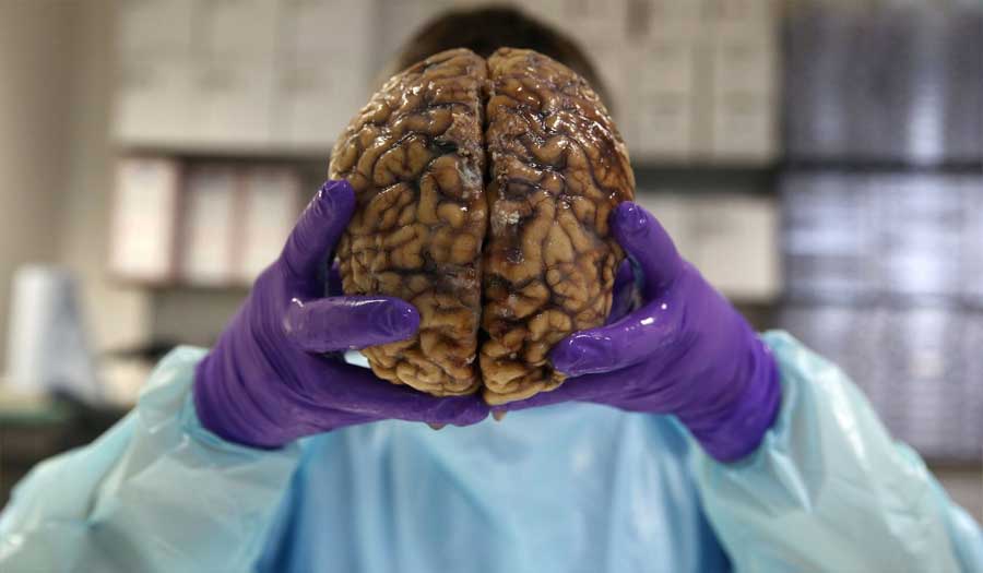 لأول مرة.. تطوير دماغ بشري في المختبر