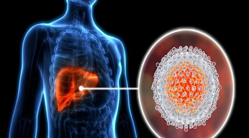 في اليوم العالمي للالتهاب الكبدي.. تعرف على طرق الوقاية والعلاج